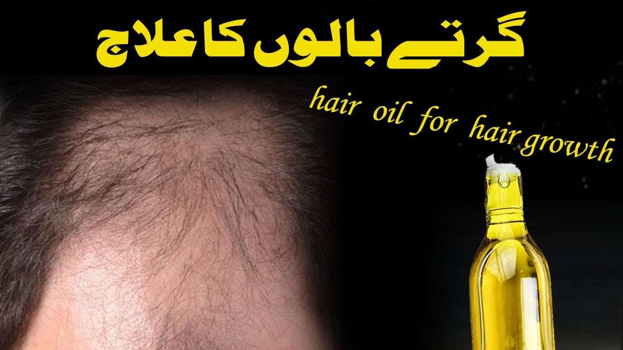 Ganjapan ka ilaj | Hair Fall Treatment